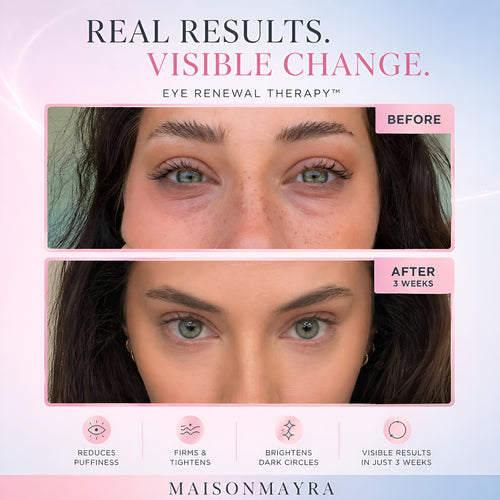 MaisonMayra™ LED Therapy Glasses – Clearer, Younger Skin in Minutes